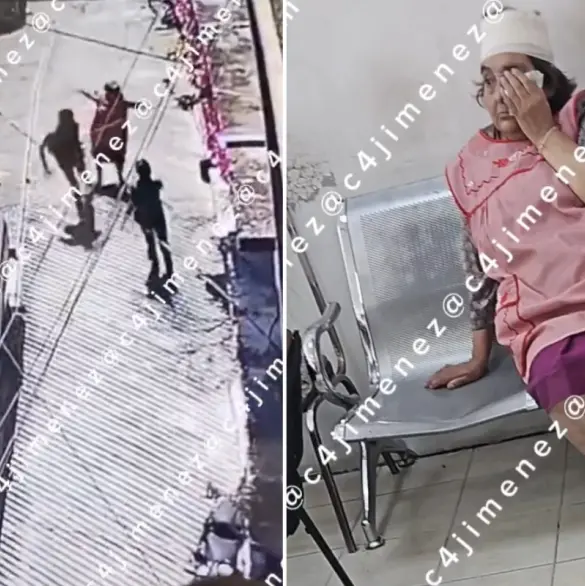 Le dio un cabezazo para robarle 800 pesos: Sujeto agrede brutalmente a abuelita en Álvaro Obregón Le dio un cabezazo para robarle 800 pesos: Sujeto agrede brutalmente a abuelita en Álvaro Obregón