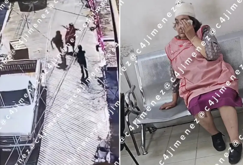 Sujeto agrede brutalmente a abuelita en Álvaro Obregón Sujeto agrede brutalmente a abuelita en Álvaro Obregón